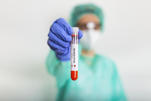Latest company news about Monkey-pox จะใช้เส้นทาง Covid-19 หรือไม่?