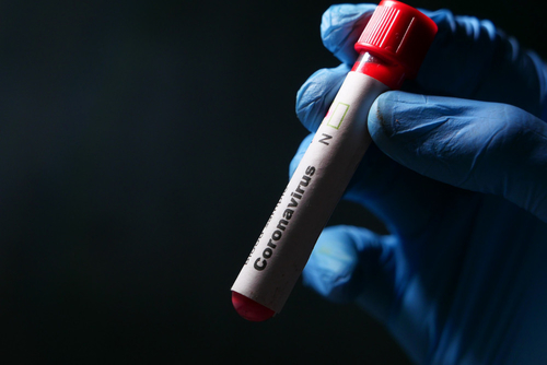 Latest company news about SARS-CoV-2 Cycle Threshold: เมตริกที่มีความสำคัญ (หรือไม่)