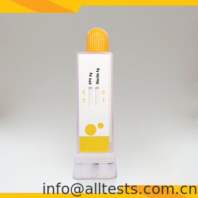 Good price FPV Giardia Lamblia Antigen Combo Test Kit ความรู้สึก ความมั่นคง ชามวัตกรรมการวินิจฉัย ออนไลน์
